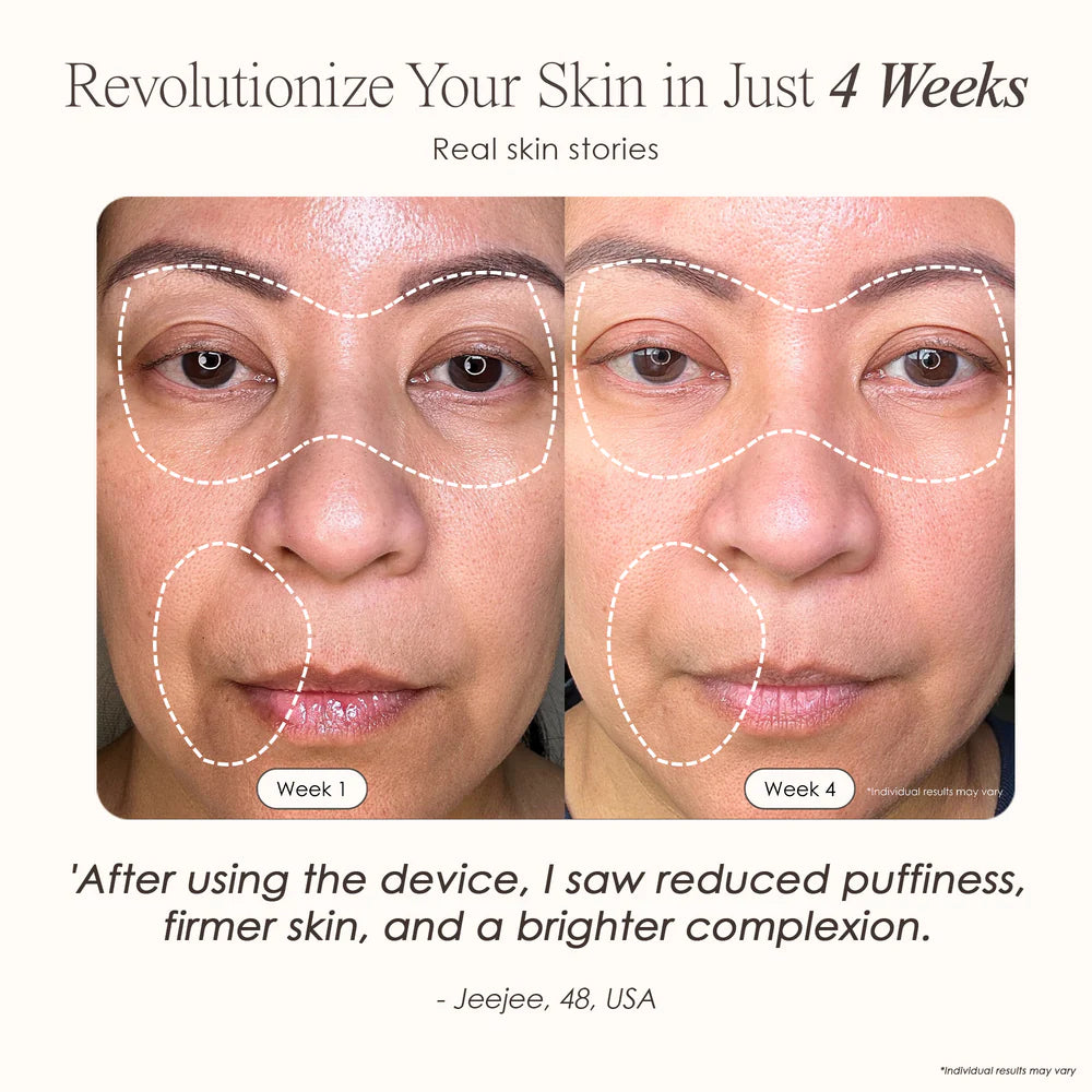 7 Color LED Skin Rejuvenation Face Mask