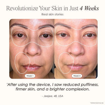 7 Color LED Skin Rejuvenation Face Mask