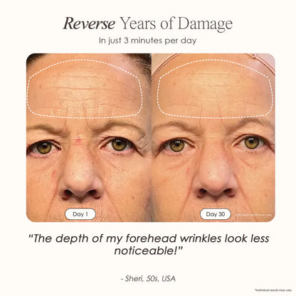 7 Color LED Skin Rejuvenation Face Mask